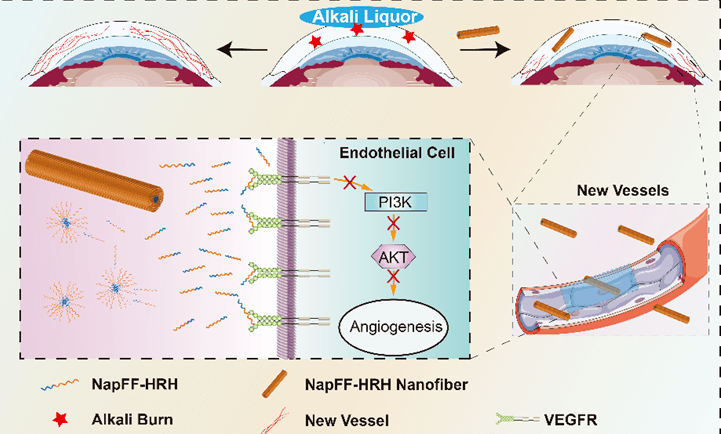 温医大眼视光黄锦海和陈世豪团队研发新型抗vegf多肽纳米纤维