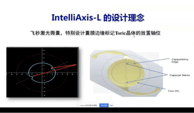 六,intelliaxis—l囊膜永久标记