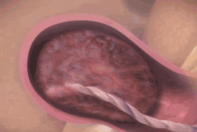 3d动图记录分娩全过程:宝妈痛不欲生时,宝宝竟会这样做!