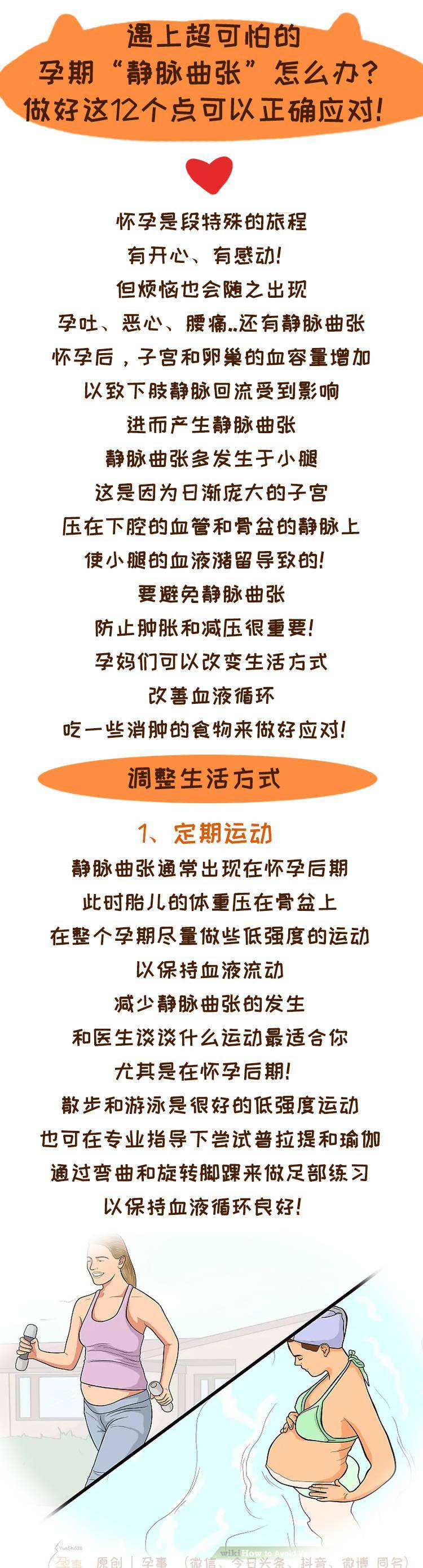 孕期遇上超可怕的静脉曲张怎么办做好这12个点可以正确应对