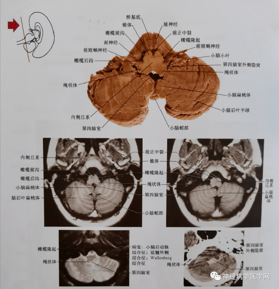 临床神经解剖图谱(断层影像 切片)