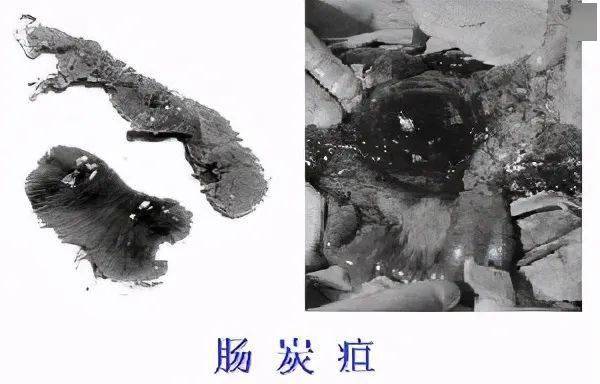 全面解读炭疽病危害有多大是否人传人怎样预防和治疗