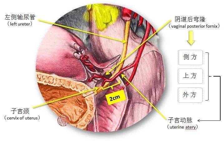 医学图说"桥下流水:子宫动脉与输尿管的交叉关系_解剖学