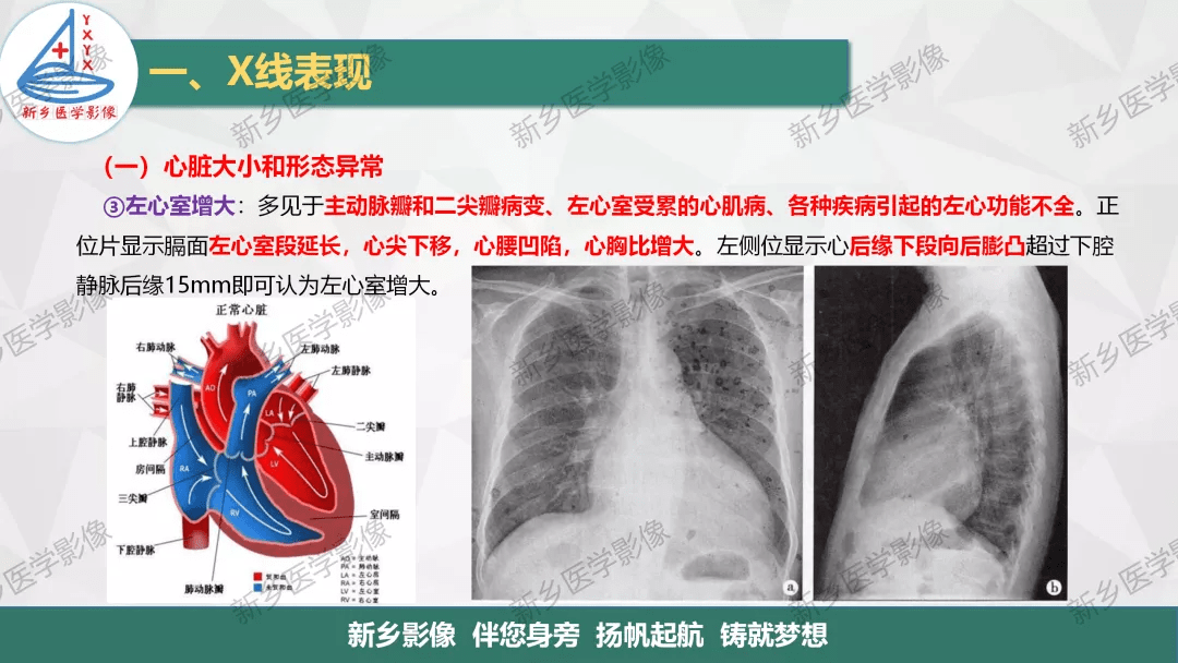 如何在胸片上观察心脏及血管的变化