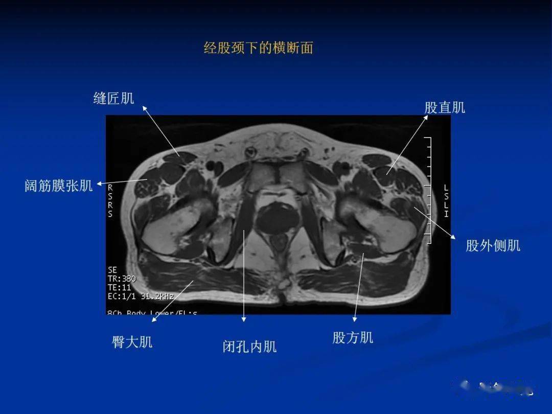 骨盆肌肉解剖_髋关节