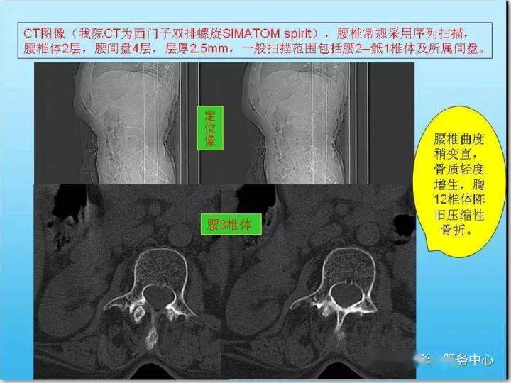 一例腰部ct漏诊病例的启示,值得一看!