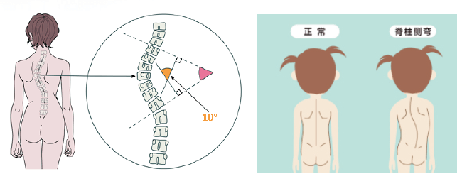 周三话健康立脊行动守护第二生命线