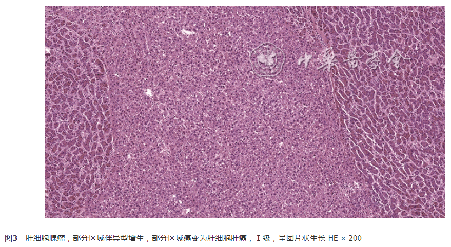 所有组织经10%中性甲醛固定,常规石蜡包埋切片,he染色,光镜下观察.