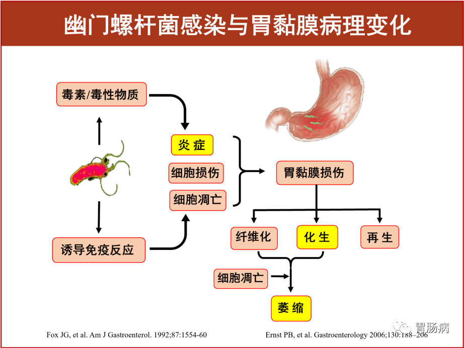 关于根除幽门螺杆菌,你不可不知的真相!_检测_mg_患者