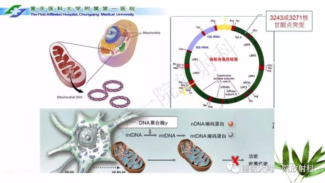 melas型线粒体脑肌病影像诊断及鉴别诊断