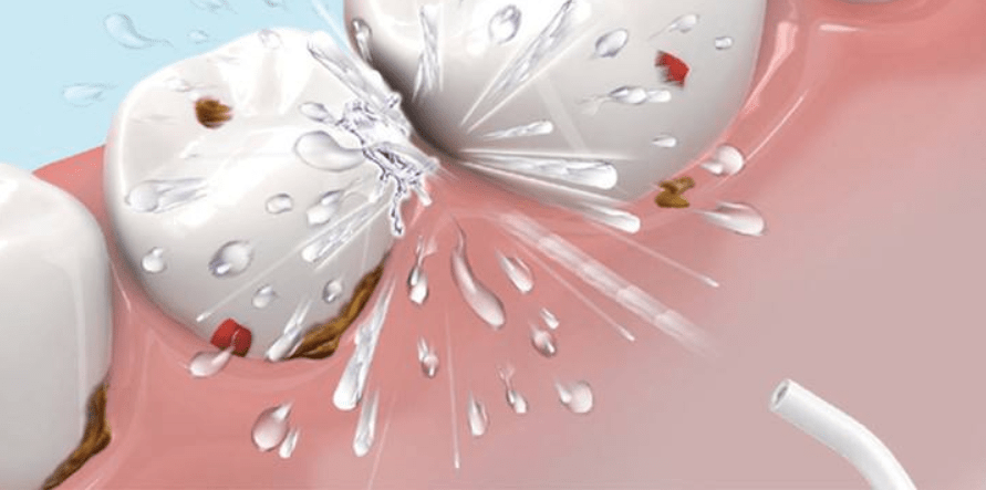 63ecc10a4fa7437994fc82b2218a4b34.png