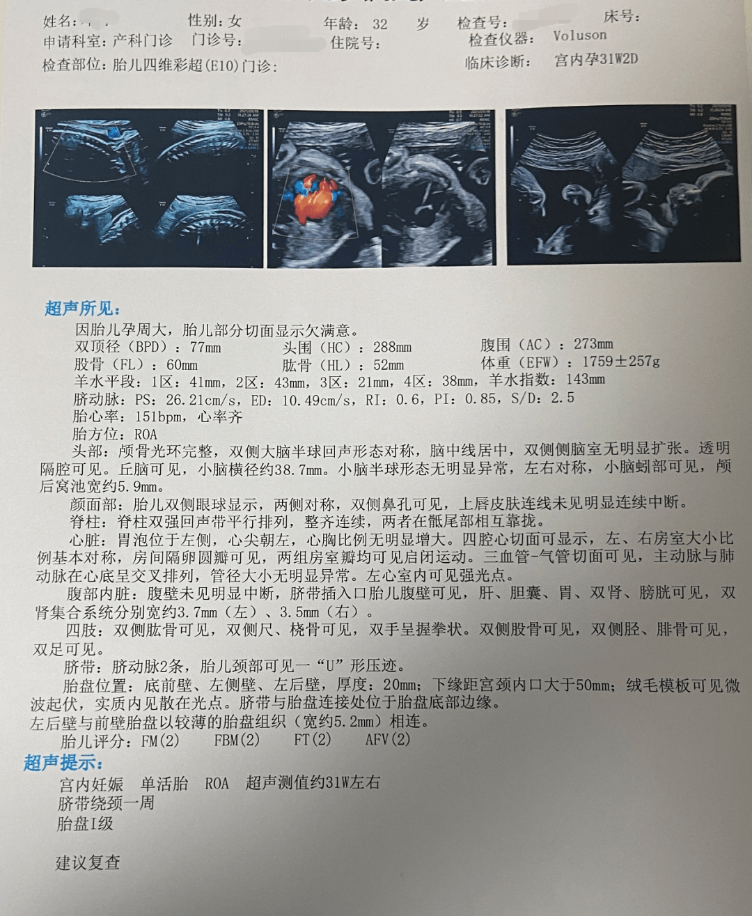 孕妈妈产检或b超结果异常这两位超强主任你得认识