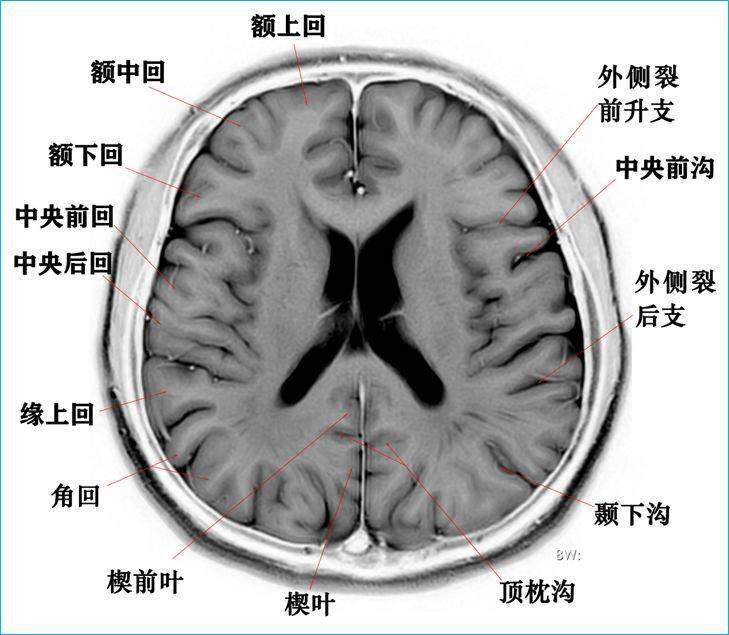 收藏高清颅脑断层解剖图谱