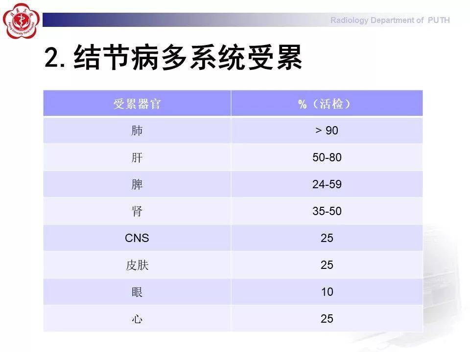 结节病的影像表现