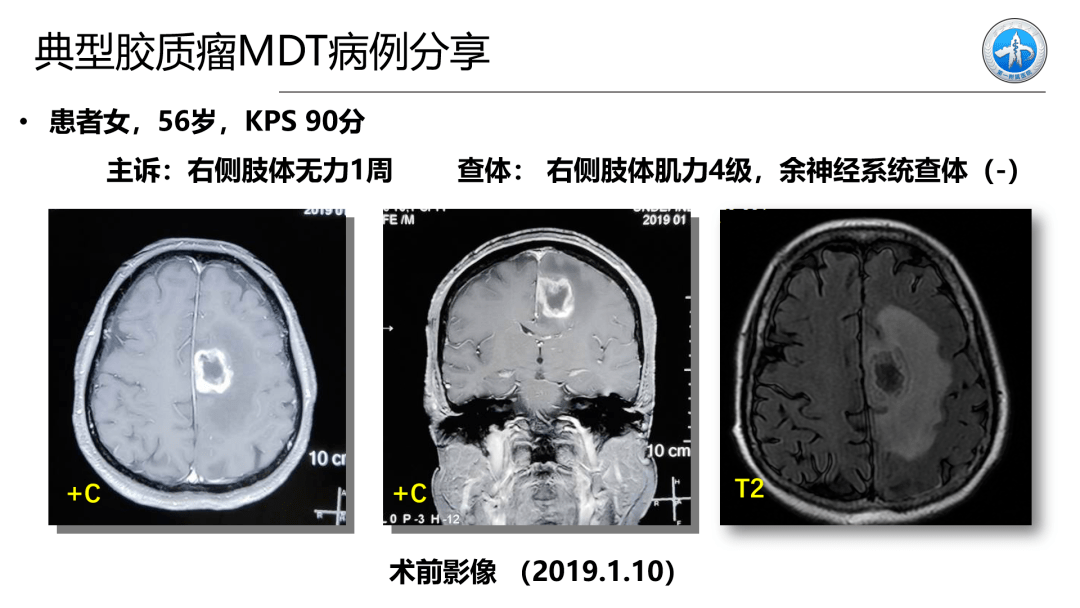 王茂德教授