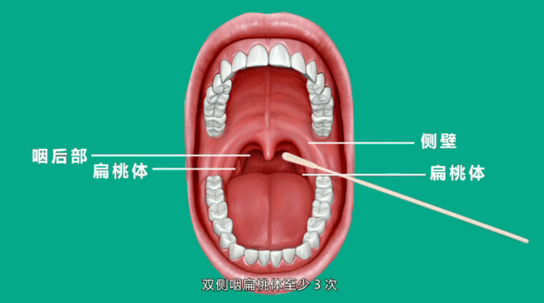 常态化核酸检测