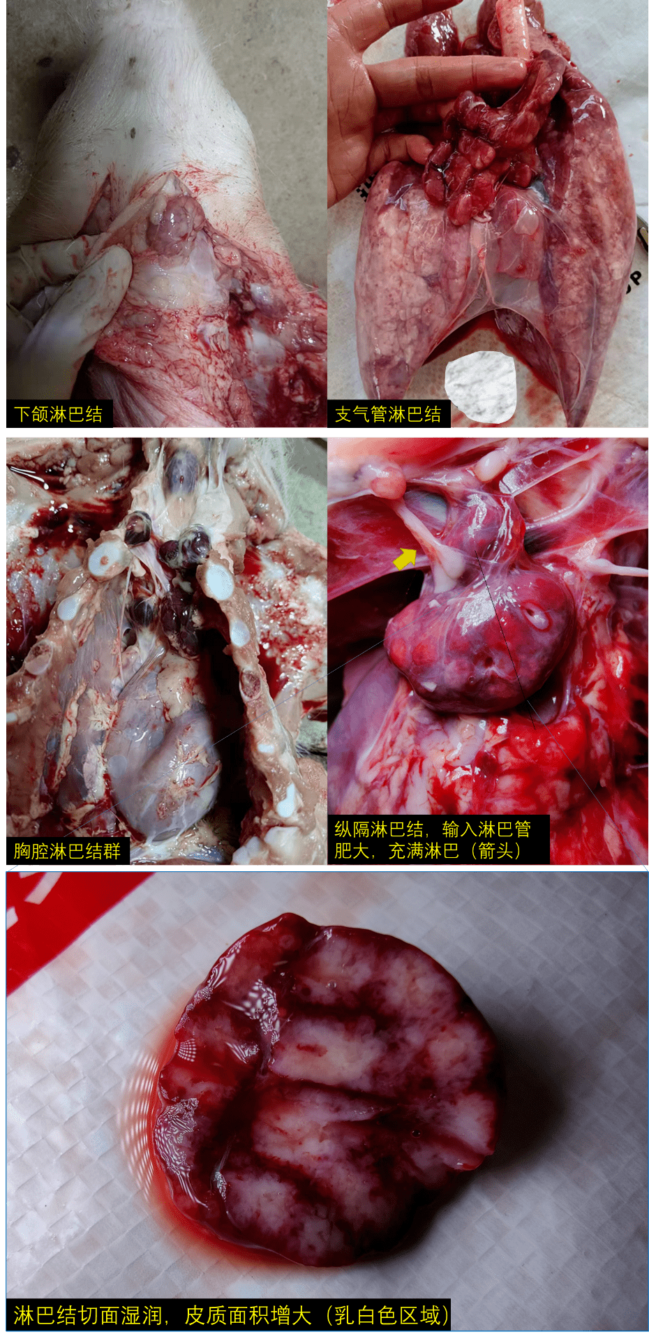 下颌,纵隔,支气管等颈胸部淋巴结肿大,充血:肺脏大体病变所有肺脏均有