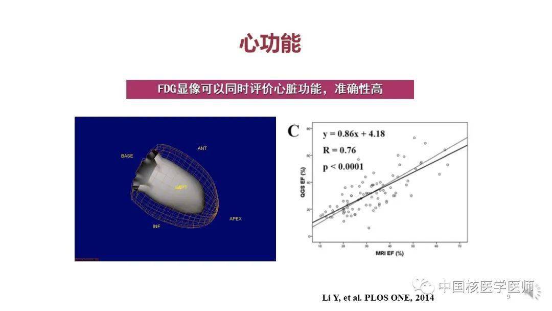 【核汇园】67期:杨敏福教授 fdg心血管显像的拓