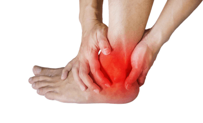 关节内骨折和严重的踝关节扭伤是最常见的创伤机制,由此引发的踝关节