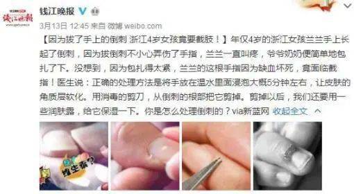 朱一龙从4岁开始咬指甲,9岁男童险被截肢,医生:都怪家长不重视_倒刺