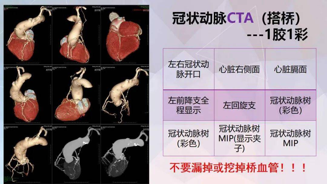 冠脉及胸痛三联cta重建规范及报告模板