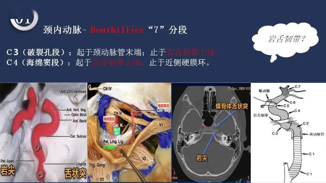 高清头颈动脉系统解剖,保你过目不忘_神经_梅斯_交流