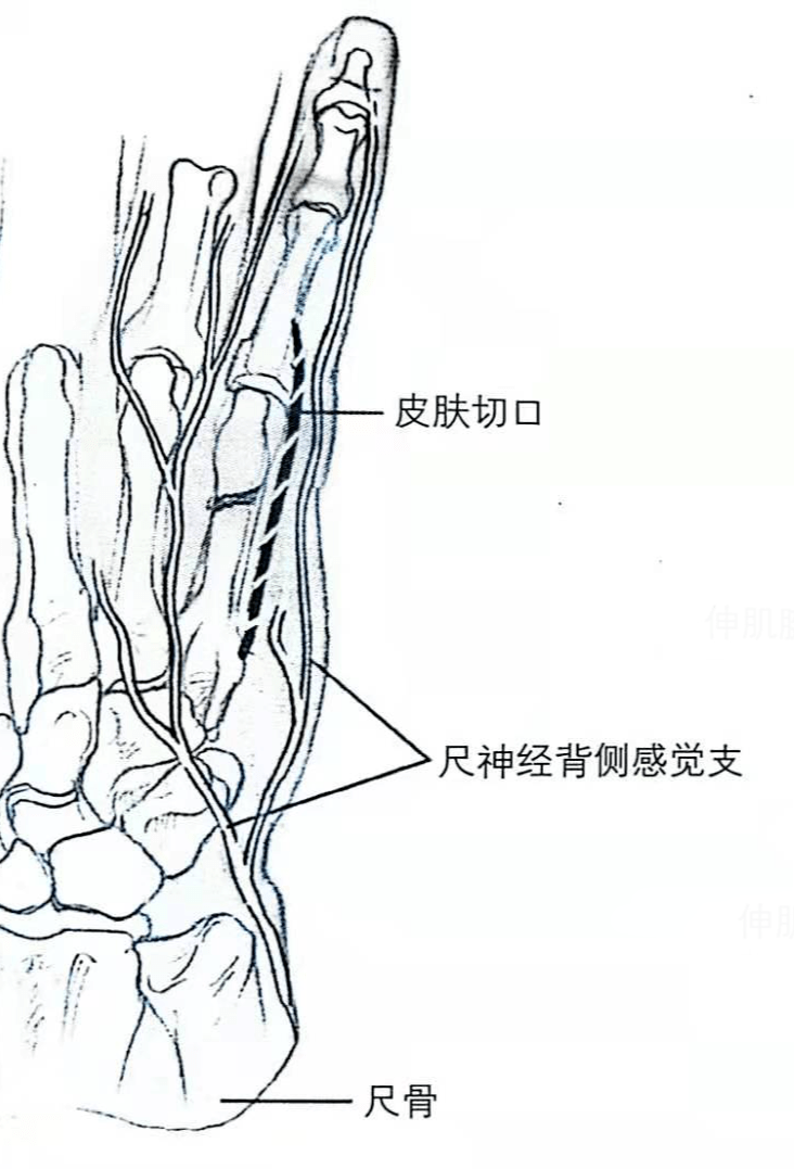 关节_移位_手指