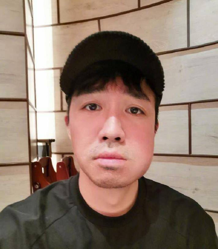 网友们都很关心俞灏明,看到他的脸肿成这样,都叫他去看医生,牙疼是很