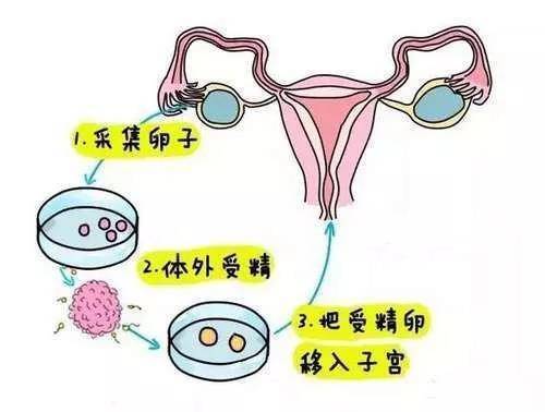 上海助孕在线（美国试管婴儿冻卵智特张欣博士：试管婴儿中移植中最关键的问题）