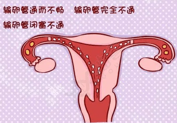 广州供卵三代包男孩（速看）