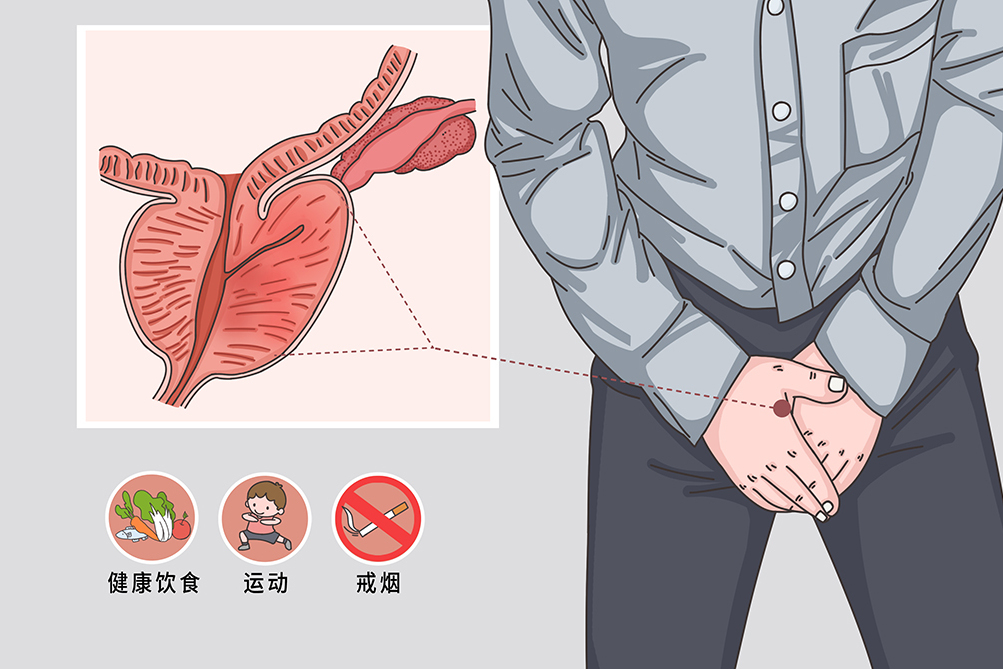 什么是细菌性前列腺炎?