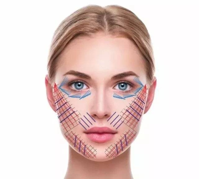 线雕原理后遗症是什么,线雕百分之九十后悔吃什么护理?