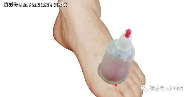 上火也有很多区别,根据不同的"火"拔罐有不同的应对方法