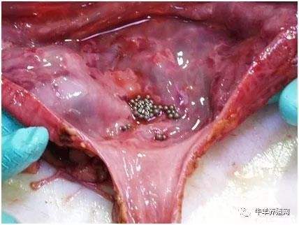新生女婴尿道口有肉芽图片