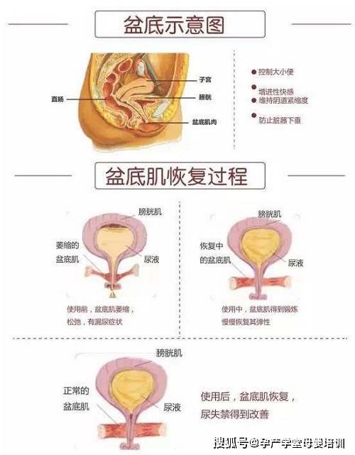 盆底肌恢复过程图解