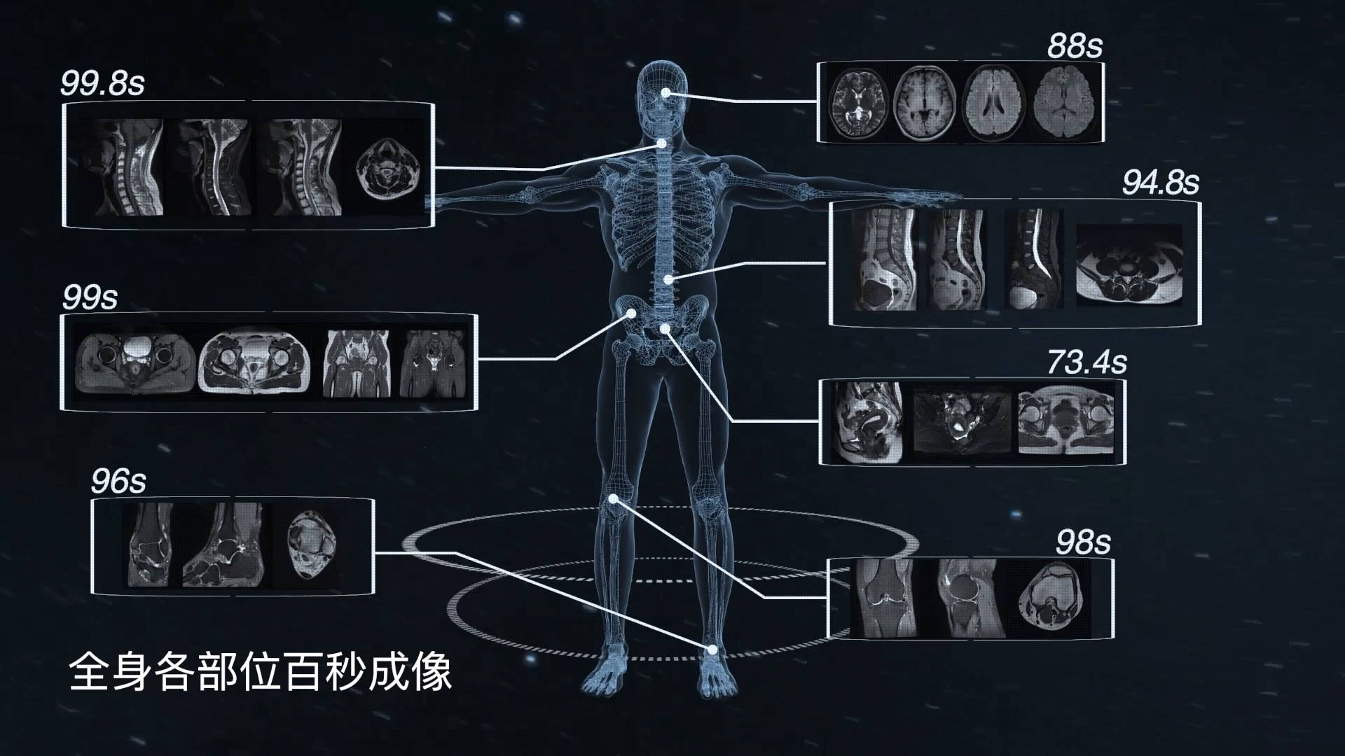 如腹部,盆腔等器官的磁共振检查容易因人体呼吸运动造成伪影,导致图像