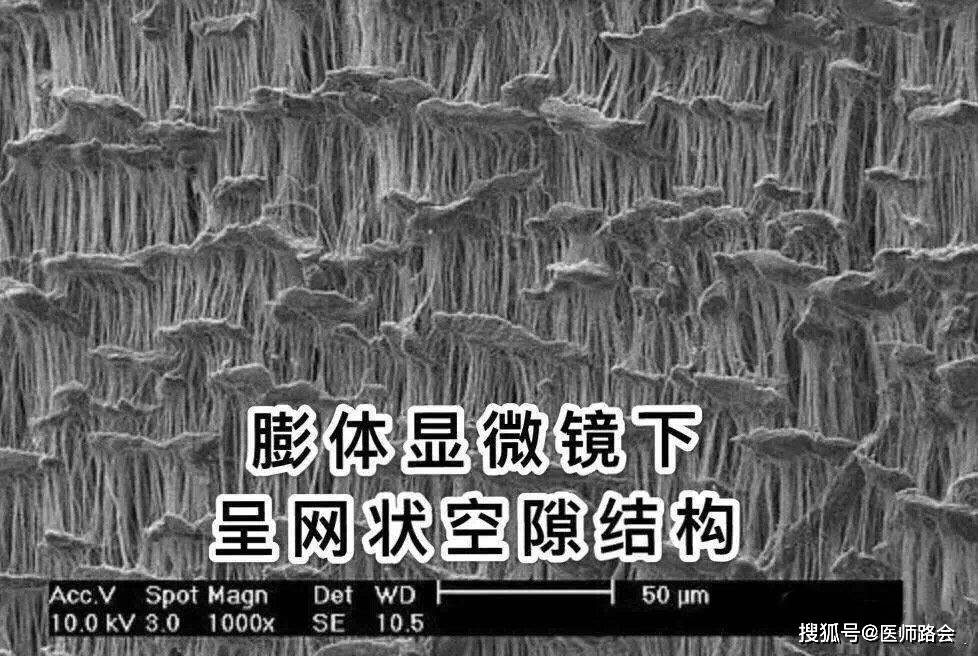 膨体特殊微孔结构能和人体有很好的相容性,也可以使膨体隆鼻保持很好