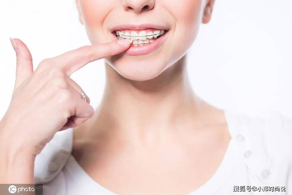 凸嘴严重,试试牙齿矫正