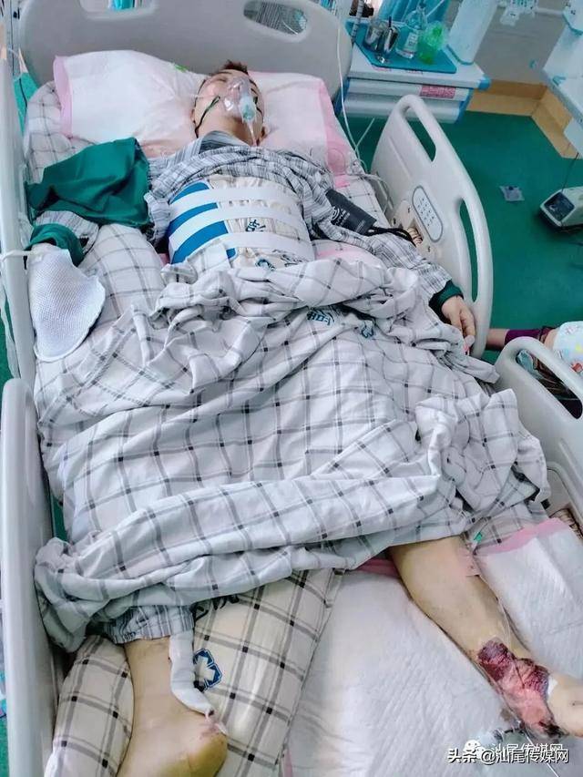 汕尾传媒网慰问一不慎坠楼伤者