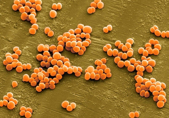 fsk-ml格式可以快速预测食品中微生物病原体引起的疾病风险