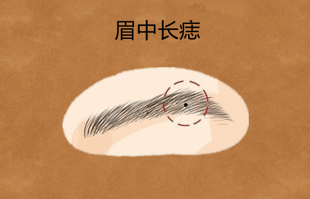 身体5大暗财痣,易藏不易露,有一个保准发大财,个个值万两