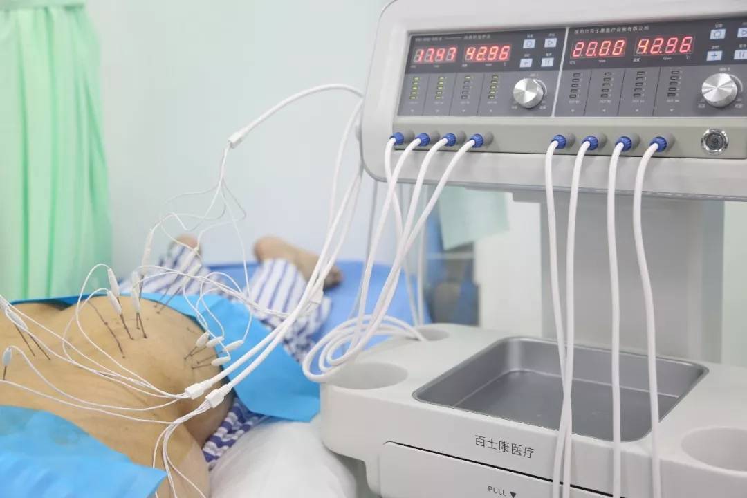 内热针治疗仪的参数说明