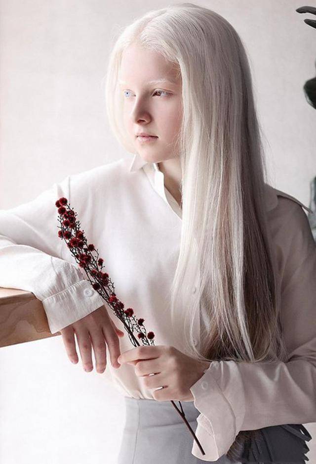 12岁女孩患罕见遗传病,外表与众不同,美的令人过目不忘_虹膜异色症