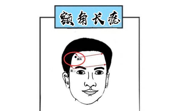 额角长痣额角就是福德宫所在的位置,位于眉尾上方左右两边的位置,代表