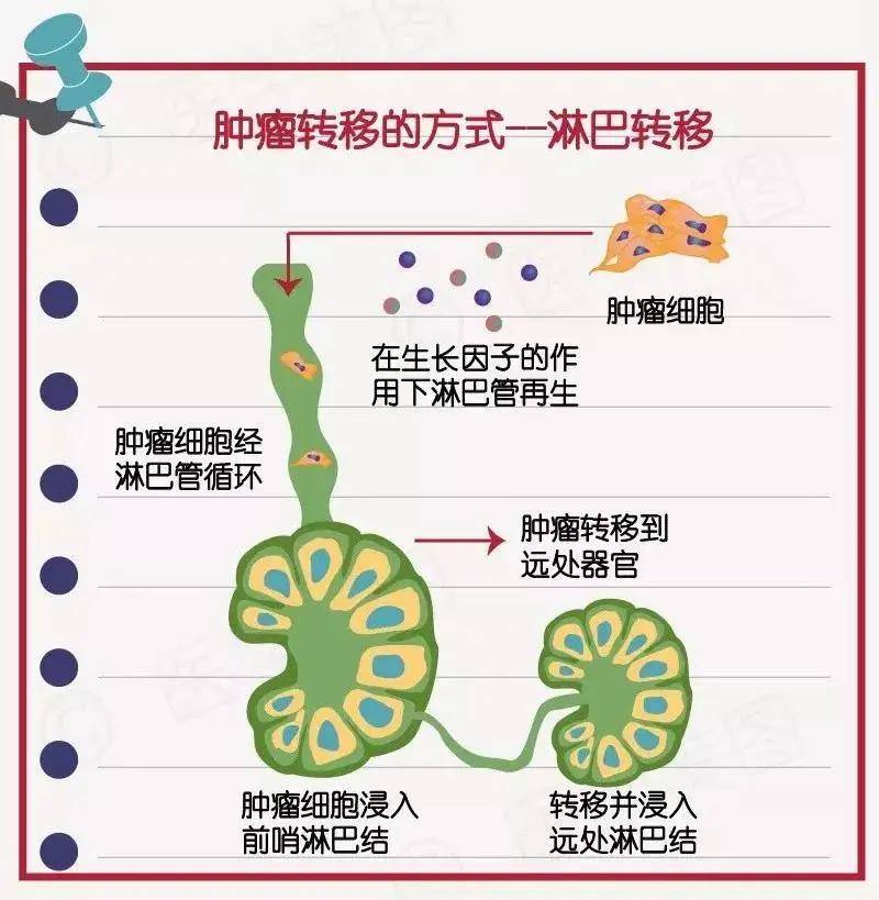 你知道肿瘤细胞是怎么攻城略地,四处转移的吗?