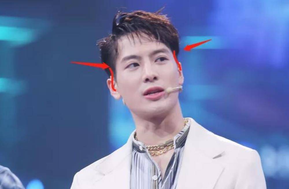 被"牙套脸"耽误颜值的艺人,林允白鹿已经够明显,当看到王嘉尔:可惜了!