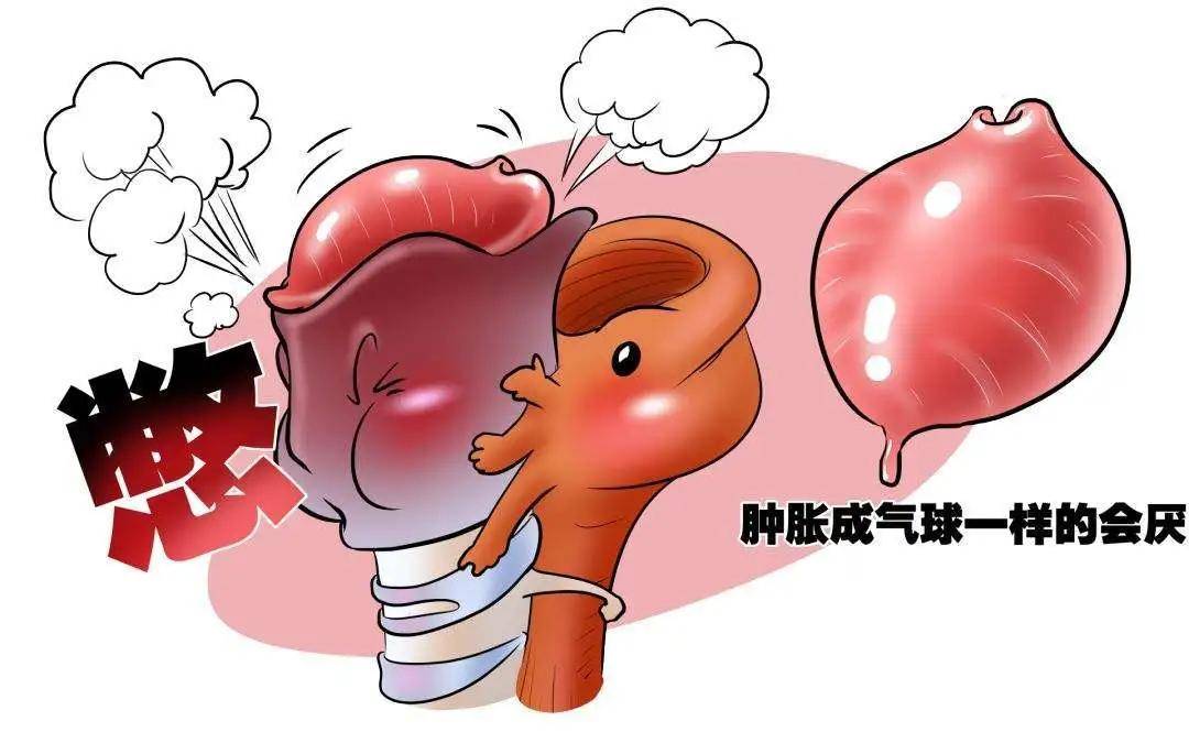 一顿饭下去误吞了金属针,开刀20万,食道卡物时谨慎这些错误行为