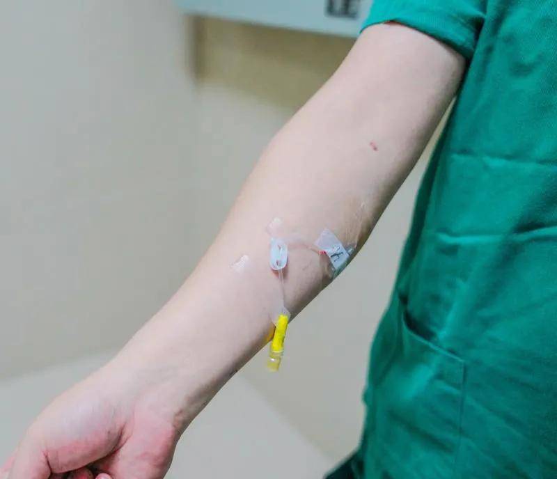 为了不影响工作,刚子医生把原本留在手背的留置针换到了手臂上 专家