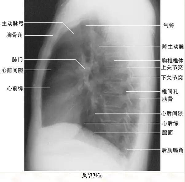 拿到胸片却不会看?送你7个窍门,手把手教你解读胸片