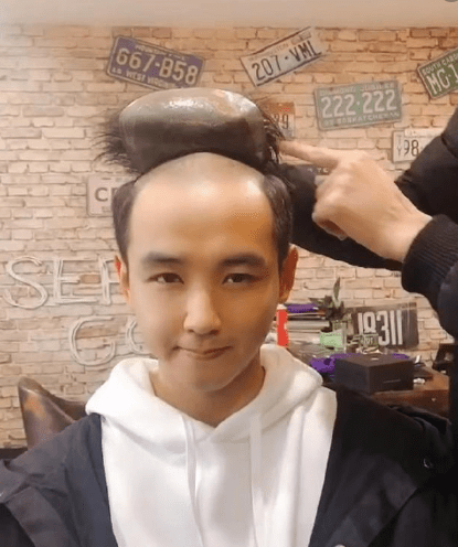 脱发男士如何拥有理想发型